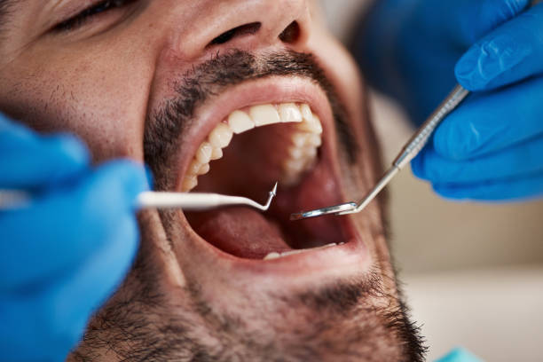 Best Emergency Treatment for Oral Infections in Bloomingdale, TN