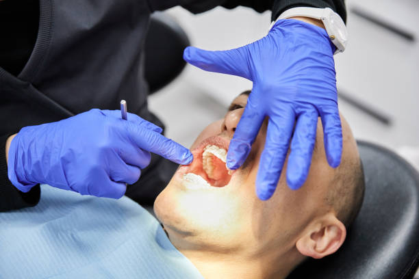 Best Knocked-Out Tooth (Avulsed Tooth) Treatment in Bloomingdale, TN