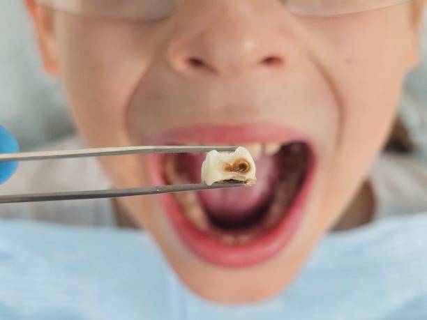 Best Emergency Cosmetic Dentistry (e.g., broken veneers) in Bloomingdale, TN